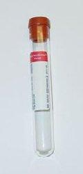 Vacutainer Tube 10mL No Additive (red)